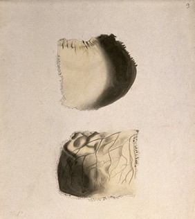 Bones of the skull: two figures. Ink and watercolour, after an unidentified work on anatomy, ca. 1830(?).