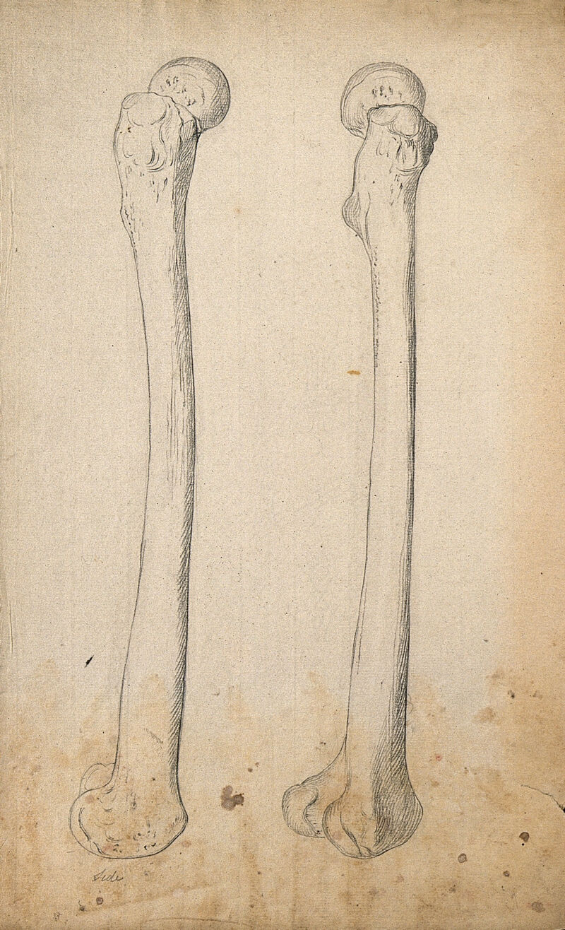 Right femur (thighbone), right side view two figures. Pencil drawing