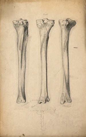 view Tibia bones: three figures. Pencil drawing, ca. 1809.