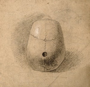 view Skull, seen from above: Hole in sagittal suture. Pencil and chalk drawing by C. Landseer(?), or a contemporary, ca. 1815.