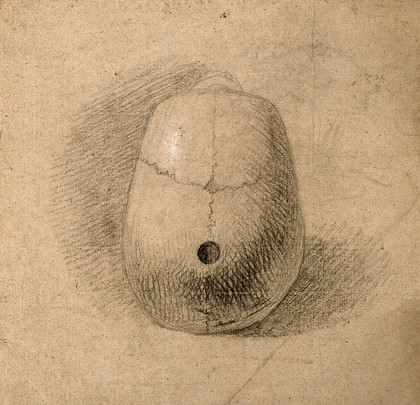 Skull, seen from above: Hole in sagittal suture. Pencil and chalk drawing by C. Landseer(?), or a contemporary, ca. 1815.