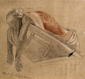 view Écorché cadaver resting on tilted support, seen from below, with arms hanging down, with the muscles of the trunk indicated. Red, black and white chalk drawing, with pencil, by C. Landseer, 1815.