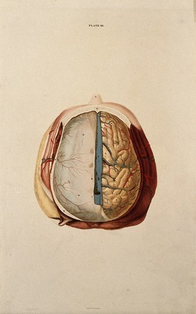 Brain: dissection showing the top of the brain, with the dura mater of the left hemisphere and the gyri of the right. Coloured line engraving by W.H. Lizars, ca. 1827.