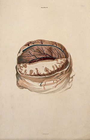 view Brain: dissection showing a section of the right hemisphere. Coloured line engraving by W.H. Lizars, ca. 1827.