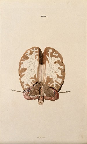 view Brain: horizontal section. Coloured line engraving by W.H. Lizars, ca. 1827.