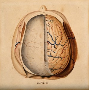 view Brain: dissection showing the top of the brain, with the dura mater of the left hemisphere and the gyri of the right. Watercolour after(?) W.H. Lizars, ca. 1826.