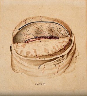 view Brain: dissection showing a section of the right hemisphere. Watercolour after(?) W.H. Lizars, ca. 1826.