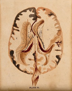 Brain: horizontal section showing lateral ventricles. Watercolour after(?) W.H. Lizars, ca. 1826.