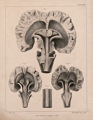 view The brain of an animal: cross-section. Lithograph by L. Aldous, 1853.