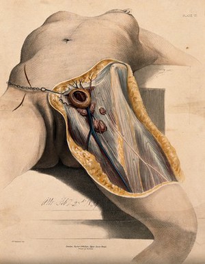 view A dissection of the groin and thigh. Coloured lithograph by A. Morton, 1839.