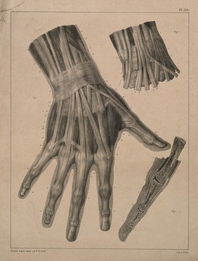 Muscles, tendons and bones of the hand: three figures. Lithograph by N.H Jacob, 1831/1854.