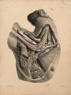view Dissection of the neck and shoulder, showing the brachial plexus. Lithograph by N.H Jacob, 1831/1854.