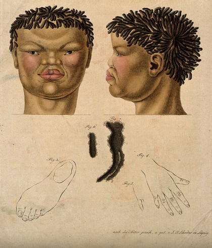 Head, neck, hand, foot and hair of a non-European woman. Coloured engraving by J.F. Schröter, ca. 1830.