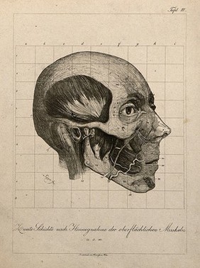 Écorché head of a man, shown at layer beneath superficial muscles, seen in profile. Etching, by A. von Perger, ca. 1850.