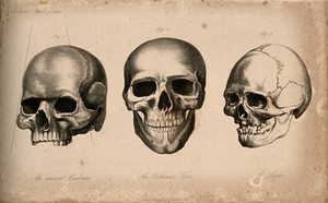 view Human skulls: three figures showing the skulls of an ancient Cimbrian, an Estonian and Laplander. Stipple engraving, 1843.