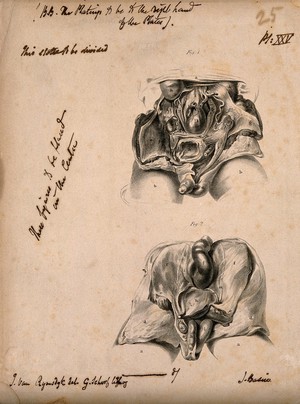 view Dissection of the male abdomen: two figures. Lithograph by G. Scharf, after J. Van Rymsdyk, 1820/1840?.
