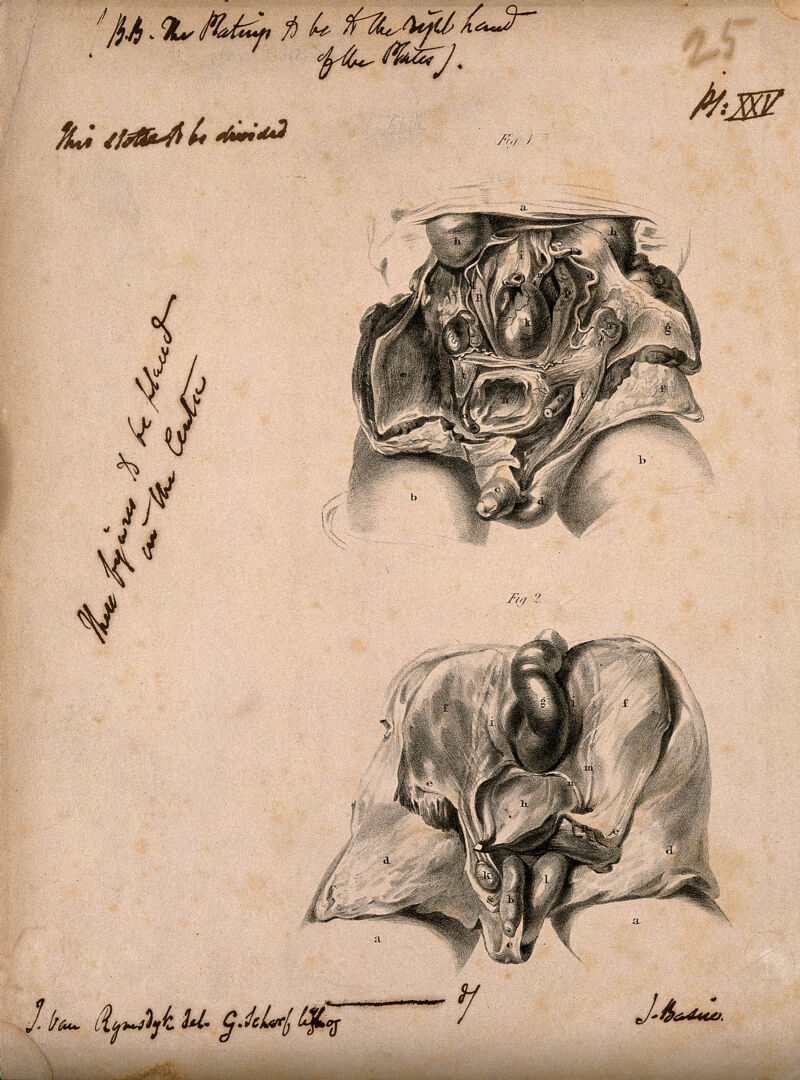 Dissection of the male abdomen: two figures. Lithograph by G. Scharf, after J. Van Rymsdyk, 1820/1840?., [1820/1840?], by Jan van Rymsdyk