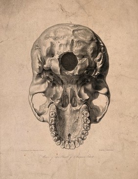 Skull of 'a human idiot' seen from below. Lithograph by G. Scharf, after J. Van Rymsdyk, 1820/1840?.