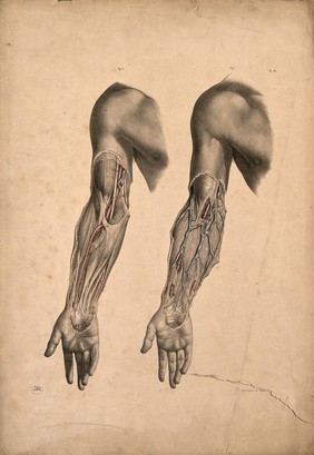 Dissection of muscles and blood-vessels of the upper arm: two figures. Coloured lithograph by J. Maclise, 1851.