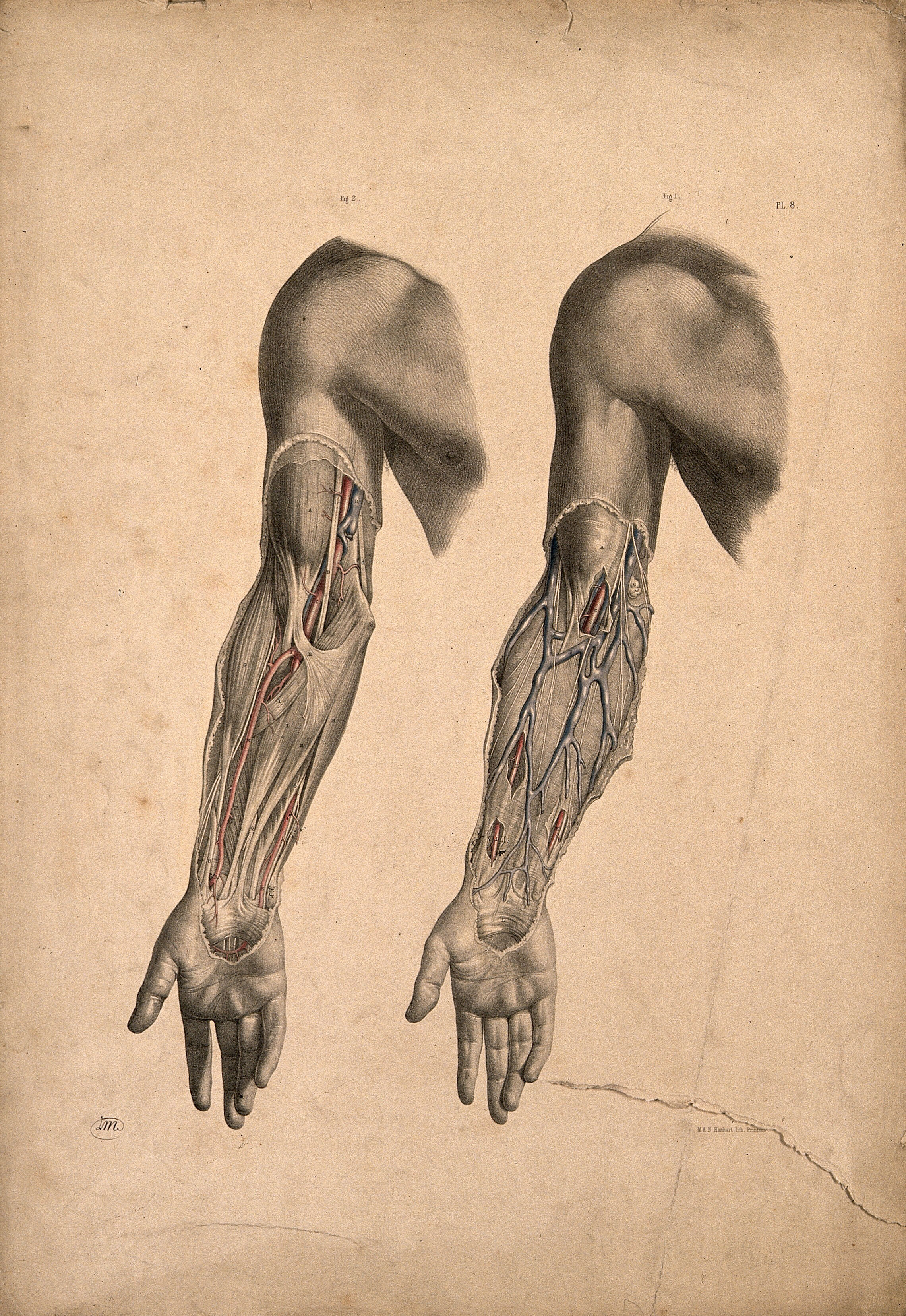 Dissection Of Muscles And Blood Vessels Of The Upper Arm Two Figures Coloured Lithograph By J Maclise 1851 Wellcome Collection