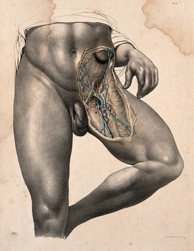 Dissection of the left groin of a standing man. Coloured lithograph by J. Maclise, 1851.