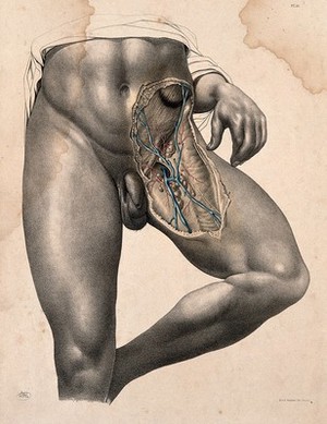 view Dissection of the left groin of a standing man. Coloured lithograph by J. Maclise, 1851.