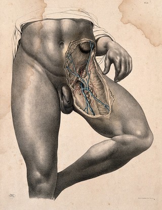 Dissection of the left groin of a standing man. Coloured lithograph by J. Maclise, 1851.
