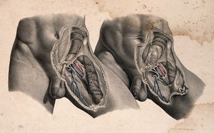 view Dissection of the left groin of a man: two figures. Coloured lithograph by J. Maclise, 1851.