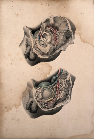 view Dissection of the pelvic organs of a man. Coloured lithograph by J. Maclise, 1851.