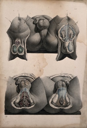 view Dissection of the anus, perinaeum and scrotum of a man. Coloured lithograph by J. Maclise, 1851.