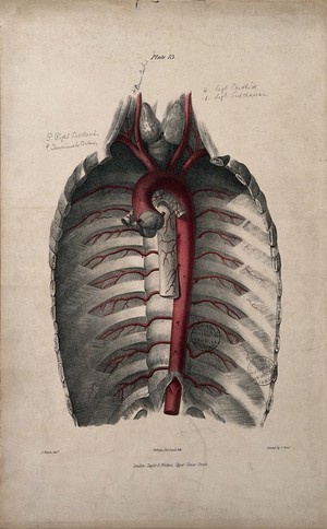 view The aorta and ribs. Coloured lithograph by William Fairland, 1837, after J. Walsh.