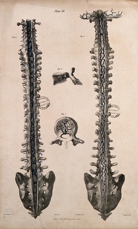 Vertebral column with veins: four figures. Coloured lithograph by William Fairland, 1837, after J. Walsh after W.J.E. Wilson.