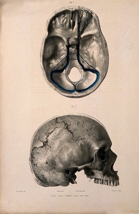 Veins of the base and inside of the skull. Coloured lithograph by William Fairland, 1837, after J. Walsh after W.J.E. Wilson.