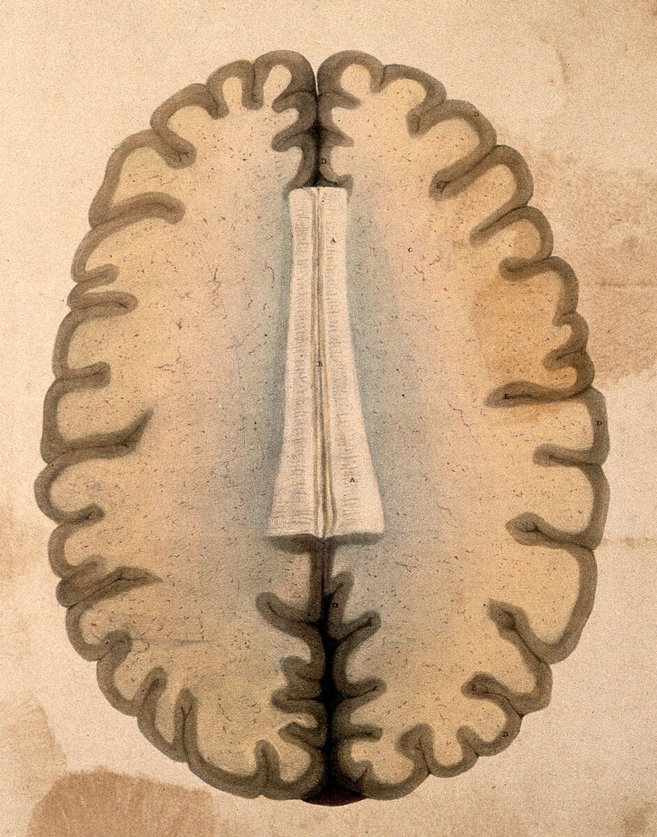 Cross-section of a human brain at the level of the corpus callosum, 1839