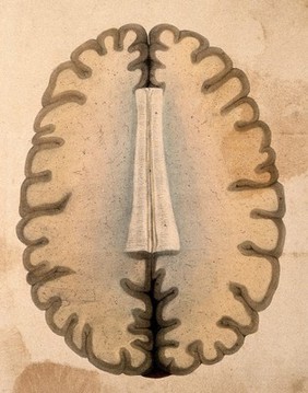 The human brain: cross-section through the hemispheres at the level of the corpus callosum. Coloured lithograph by William Fairland, 1839, after W. Bagg after W.J.E. Wilson.