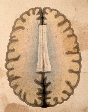 view The human brain: cross-section through the hemispheres at the level of the corpus callosum. Coloured lithograph by William Fairland, 1839, after W. Bagg after W.J.E. Wilson.