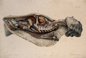 view The body of a man lying down, with his trunk dissected to reveal the ribs and viscera. Coloured lithograph by William Fairland, 1869.