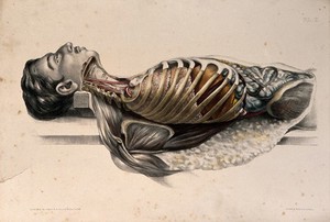 view The body of a man lying down, with his trunk dissected to reveal the ribs and viscera. Coloured lithograph by William Fairland, 1869.