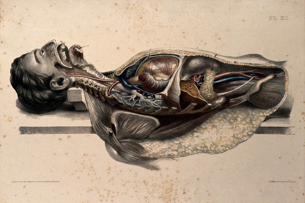 The body of a man lying down, with his face and trunk dissected to reveal the ribs and viscera. Coloured lithograph by William Fairland, 1869.