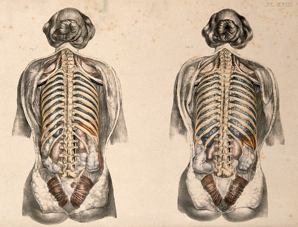 The body of a woman seen from behind with the trunk dissected: two figures showing the lungs after breathing out (left) and after breathing in (right, simulated by inflating the lungs). Coloured lithograph by William Fairland, 1869.