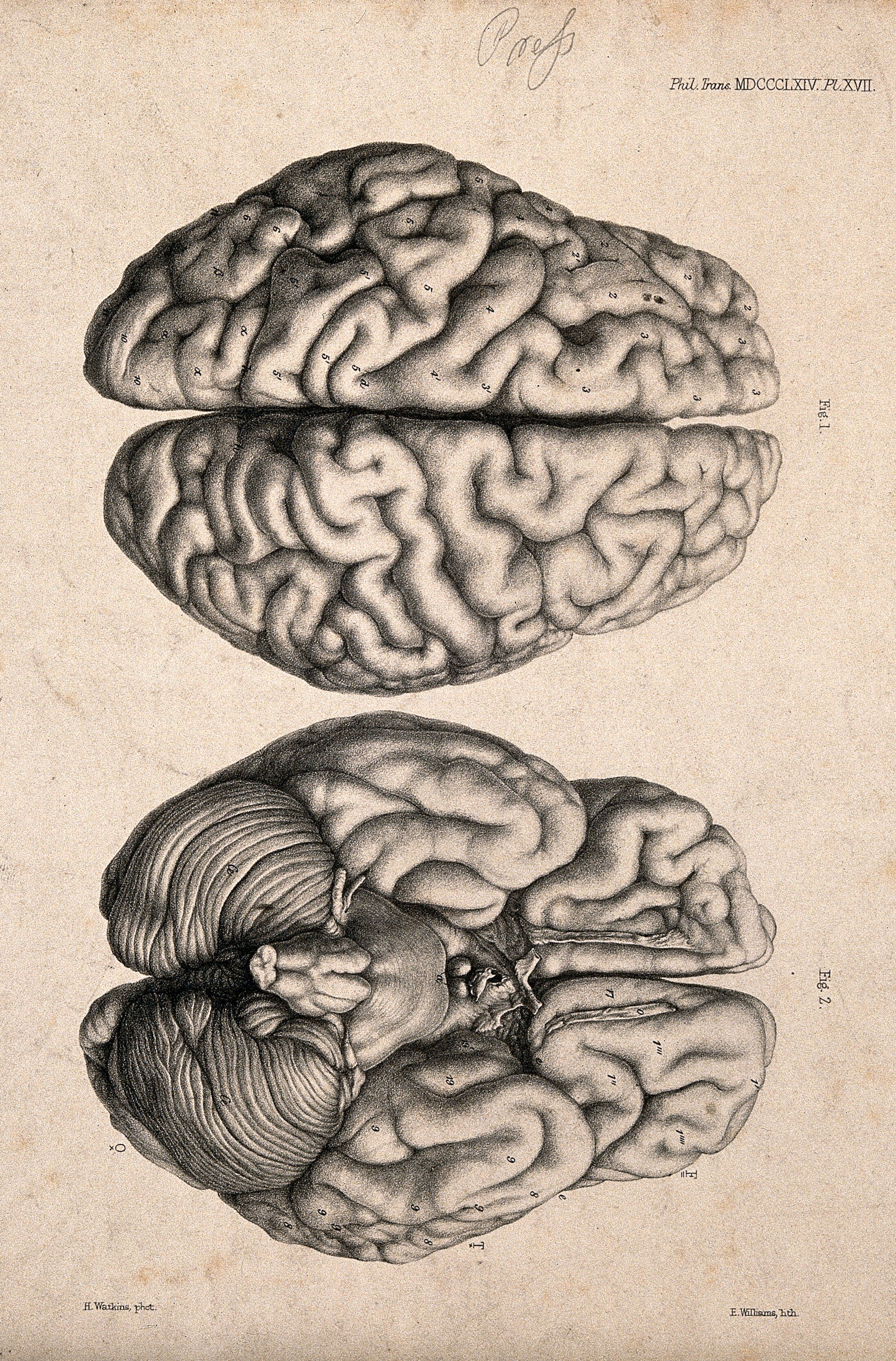 M brain