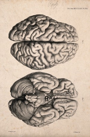 view Brain of an African Bushwoman: two figures, views from above and below. Lithograph by E.M. Williams after H. Watkins, 1864.
