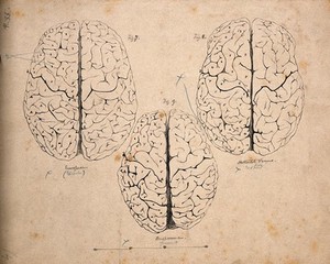 view Gyri of the brain: three figures, one of a European, one of the "Hottentot Venus", and one of an African Bushwoman. Lithograph by E.M. Williams after H. Watkins, 1864.
