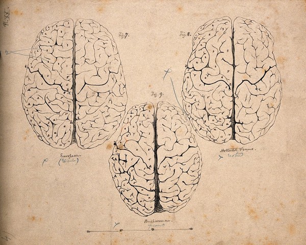 Gyri of the brain: three figures, one of a European, one of the "Hottentot Venus", and one of an African Bushwoman. Lithograph by E.M. Williams after H. Watkins, 1864.