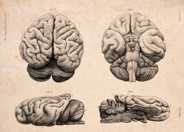 Brain of a "European female idiot" aged 42 years: four figures. Lithograph by E.M. Williams after H. Watkins, 1864.