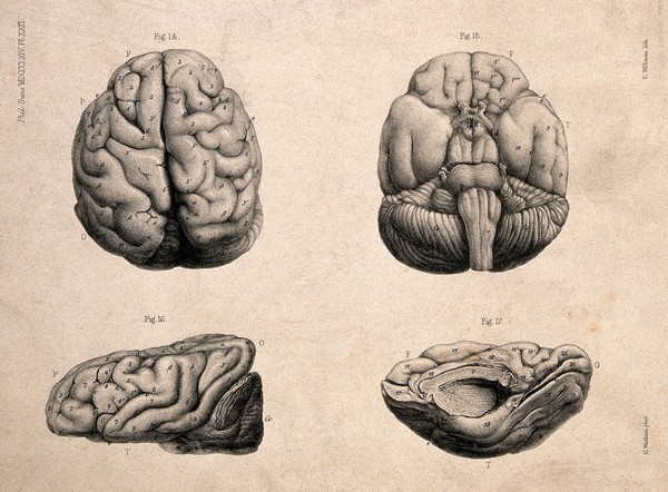 Brain of a "European male idiot" aged 12 years: four figures. Lithograph by E.M. Williams after H. Watkins, 1864.