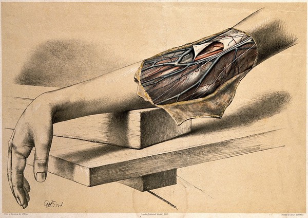 Dissection showing the blood vessels and nerves of the elbow. Colour lithograph by G.H. Ford, 1863.