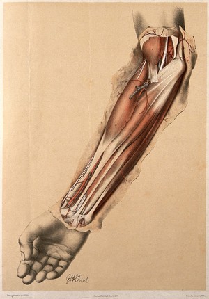 view Dissection of the fore-arm. Colour lithograph by G.H. Ford, 1863.