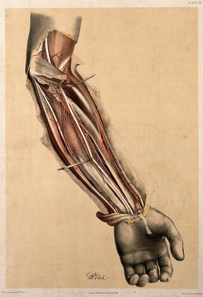 Dissection of the fore-arm, showing the muscles and nerves. Colour lithograph by G.H. Ford, 1863.