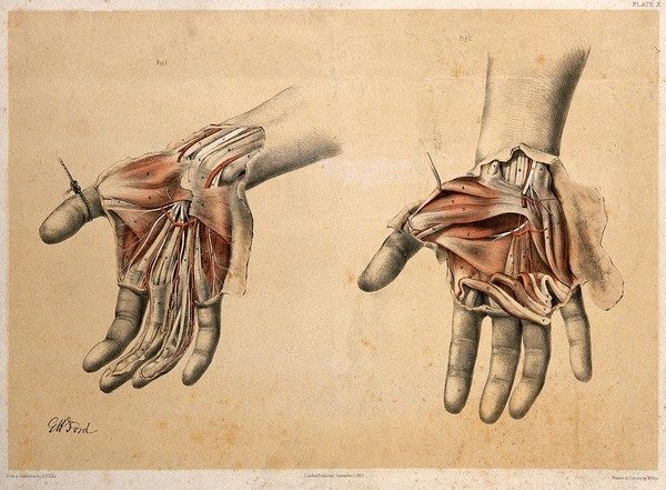 Dissections of the palm of the hand: two figures. Colour lithograph by G.H. Ford, 1863.